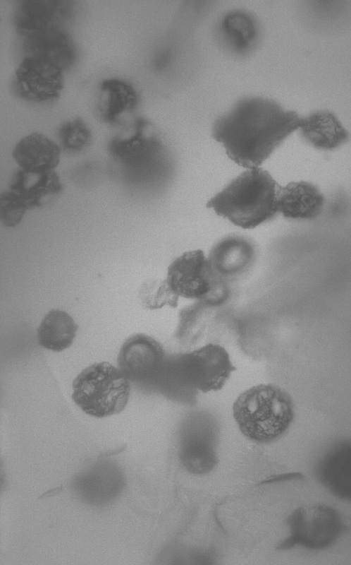 Phryganella paradoxa ist die häufigste beschalte Amöbe des Schliersee-Harzes (Größe ca. 30 µm). (Foto: Uni Jena)