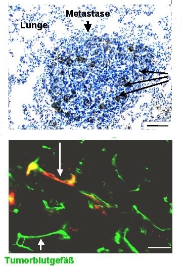 In die Metastase eingewanderte Stammzellen haben sich in die Blutgefäße des Tumors eingebaut.