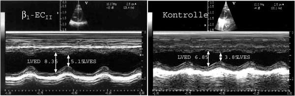 Ultraschall an Rattenherzen. Rechts ein gesundes Tier, links ein Tier mit krank machenden Beta1-Rezeptor-Antikörpern. Gezeigt sind Querschnitte durch die linke Herzkammer. Man sieht: Beim kranken Tier (links) ist sie stark vergrößert. Grafik: Jahns