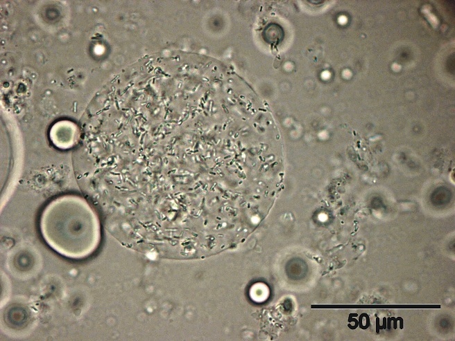 Mikrogel mit Lactobacillus acidophilus