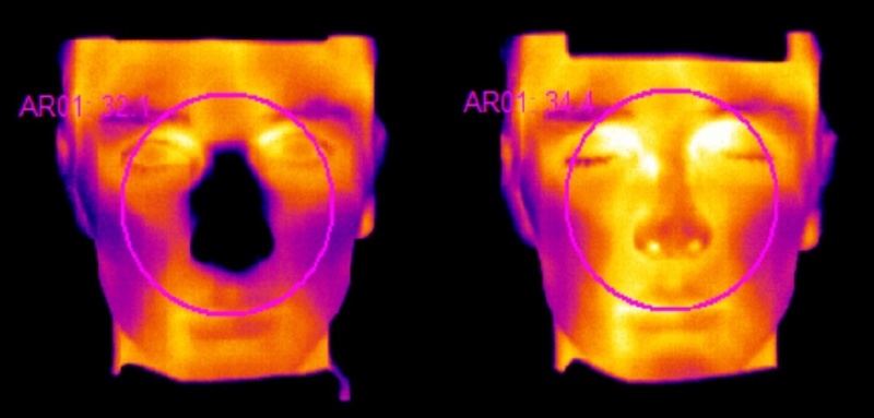 In diesem Fall bekam der Proband vorab ein Placebo statt ein Antihistaminikum. Die Stimulation mit Histamin führt dazu, dass sich die Nase im Infrarotbild rechts deutlich erwärmt. © Fraunhofer ITEM