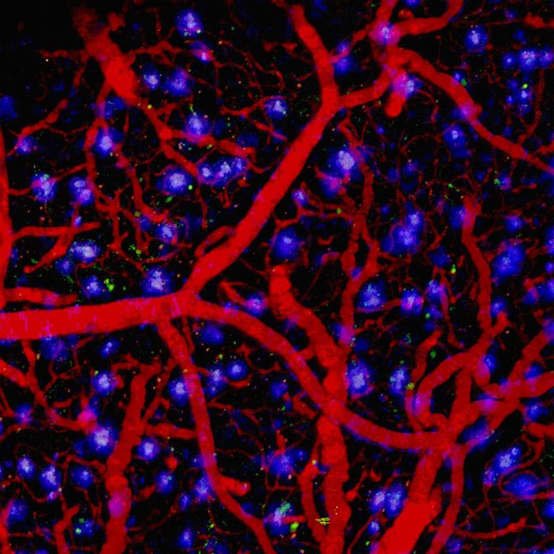 In vivo-Nachweis der ß-Amyloid- Ablagerungen (blau) im Gehirn eines transgenen Tiermodells der Alzheimerschen Erkrankung. In Rot sind Gefäße markiert.