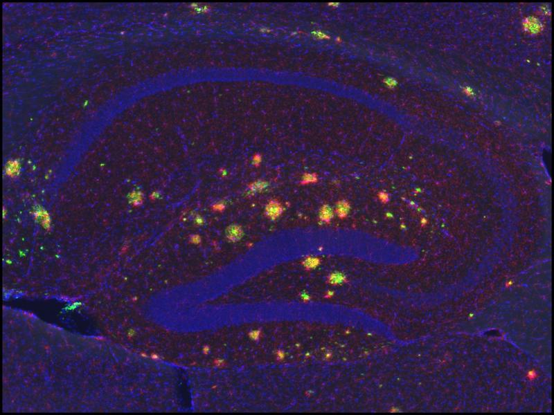 Hippokampus im Modellorganismus für Alzheimer-Demenz: Die gelben Punkte stellen die Amyloid-Plaques dar. Sie treten bei Alzheimer Patienten gehäuft auf. Die Anhäufung Proteinen wie dem beta-Amyloid scheint bei der Zerstörung von Nervenzellen und damit bei neurodegenerativen Erkrankungen wie der Alzheimer-Erkrankung eine wichtige Rolle zu spielen.