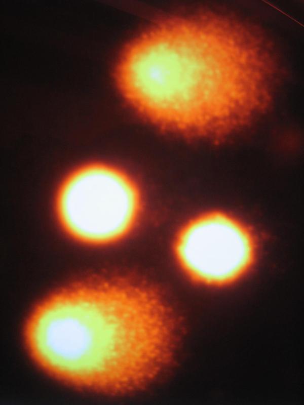 Der "Comet-Assay" liefert Informationen über den Grad einer DNA-Schädigung, die zur Krebsentstehung führen kann. Hier zu sehen sind DNA-Verbände mit ungeschädigter (Bildmitte) und geschädigter DNA (oben und unten), zu erkennen als "Kometenschweif".