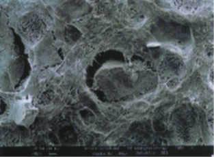 So sieht der neue Kunsstoff unter einem Rasterlelektronenmikroskop aus: Feine Fäden verbinden das Gummiteilchen (Mitte) mit seiner Umgebung. Vergrößerung: 500fach. Fotos: Dr. Hannes Michael (1), Institut für Polymerforschung, Dresden (1).