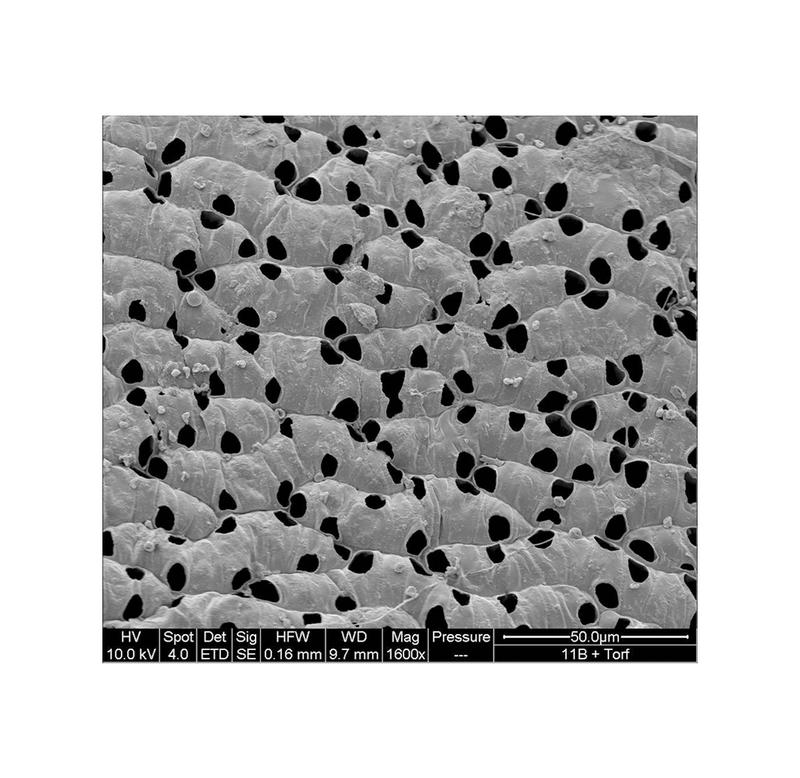 Mit Tonmineralen beschichtete Blätter von Sphagnum Moos aus einem Torf-basierten gärtnerischen Substrat (elektronenmikroskopische Aufnahme)