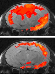 Magnetresonanztomographische Querschnitte durch das Gehirn von Mäusen mit Arthritis vor (oben) und nach Hemmung von Tumornekrosefaktor (unten). Vor der Hemmung zeigt sich eine deutlich sichtbare Gehirnaktivität, die durch die Therapie deutlich eingeschränkt wird. 