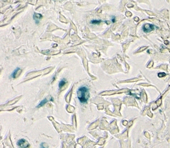 Interferon-γ induzierte Seneszenz in Tumorzellen. Die Abbildung zeigt aus Mäusen isolierte Tumorzellen aus der Bauchspeicheldrüse (β-Zellen), die mit dem Botenstoff Interferon-γ für 72 Stunden behandelt wurden. Die Blaufärbung der Zellen rührt von der Aktivierung der Seneszenz-assoziierten β-Galaktosidase Aktivität.