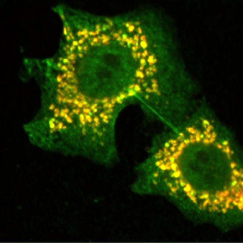 Diese ringförmigen Strukturen sind die Steroidhormon-Rezeptoren in Mitochondrien. Das Bild zierte die Titelseite des "European Journal of Cell Biology" Nr. 79 (2000). Es wurde mittels konfokaler Laser-Scanning-Mikroskopie aufgenommen. Bild: Hansen