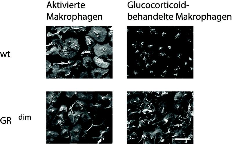 Die Funktion des Glucocorticoid-Rezeptors als Doppelmolekül (Dimer) wird für die Hemmung entzündlich aktivierter Makrophagen durch Glucocorticoide benötigt.  Normale Makrophagen (wt, obere Reihe) und Makrophagen mit einem Glucocorticoid-Rezeptor ohne Dimerisierungsfunktion (GRdim, untere Reihe) besitzen eine breite, flächige Form nach Aktivierung (linke Spalte). Die Glucocorticoid-Behandlung, z.B. mit Cortisol, führt zu einem abgerundeten Aussehen normaler Makrophagen (oben rechts), dieser Effekt wird nicht bei Makrophagen ohne Dimerisierungsfunktion beobachtet (unten rechts). Ein Indiz dafür, dass in Abwesenheit der Dimerisierung des Glucocorticoid-Rezeptors keine entzündungshemmende Wirkung von Glucocorticoiden stattfindet.  Gezeigt sind Aufnahmen von einem Rasterelektronenmikroskop von Dr. Walter Richter.