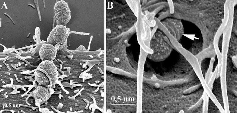 Gefährlicher Angriff von Streptokokken der Gruppe C auf eine menschliche Zelle (links) und Eindringen in eine Zelle (rechts)
