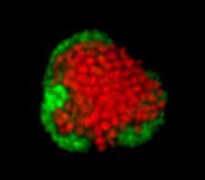 Symbiose aus Archaebakterien (rot) und sulfatreduzierenden Balterien (gruen)