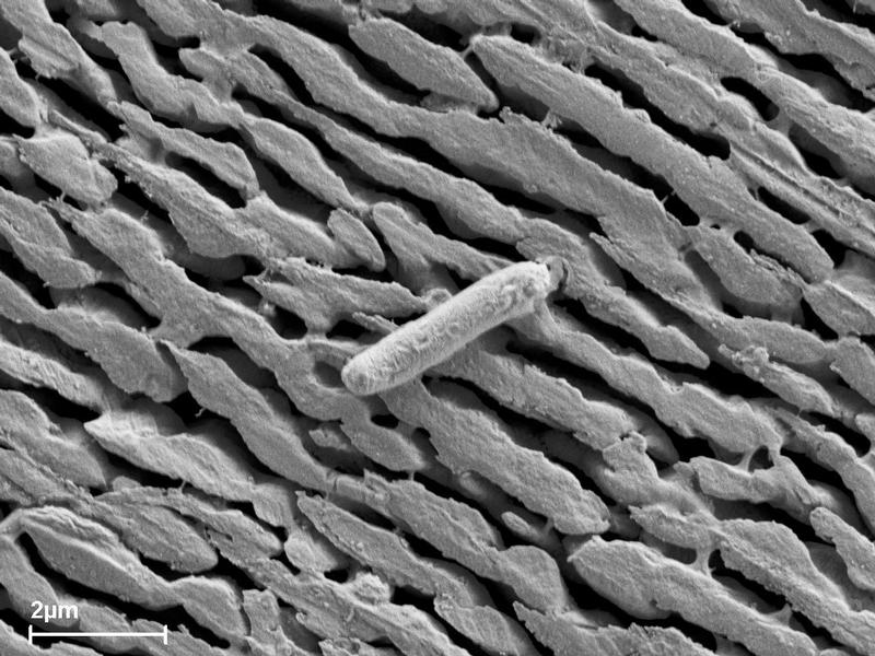 Ein Größenvergleich: Nanoporöse Metallmembran mit E.coli-Bakterium.