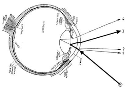 Strahlengang für die Messung der Glukosekonzentration in der Vorderkammer des Auges, wobei die Reflexion an der Linsenvorderfläche (Position 3) genutzt wird. In Position X befindet sich eine Infrarotlichtquelle. Grafik: Schrader