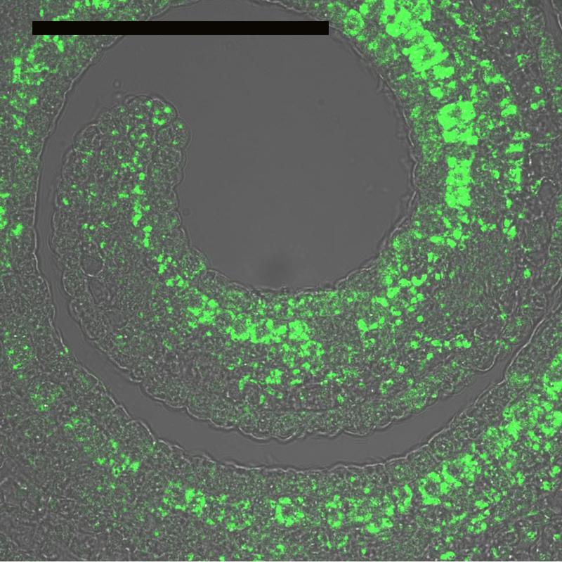 Immunolabeling (green areas) of MecgoR, the enzyme catalyzing the penultimate step of cocaine biosynthesis. The picture shows the strong accumulation of the enzyme in a cross section of a very young E. coca leaf, which is still curled around the growing stem tip. Bar: 0,1 mm.
