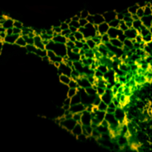 In höheren Zellen verbleiben fehlgefaltete Membranproteine im Endoplasmatischen Retikulum (ER). Das mikroskopische Bild zeigt ein beschädigtes Membranprotein (grün) und ein ER-Protein (rot). Wo beide Proteine gemeinsam vorkommen, ergibt sich eine gelbe Färbung. 