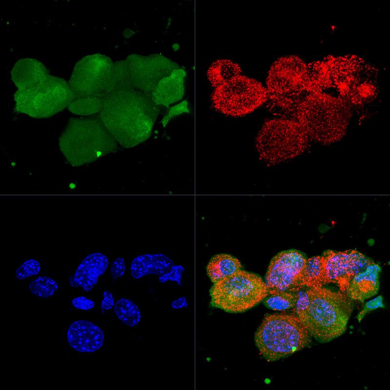 Doppelmarkierung mesenchymaler Stammzellen (MSCs) mit grün-fluoreszierendem Protein (GFP, stabile Transfektion) und PKH26 (rot, blau = DAPI-Kernfärbung).