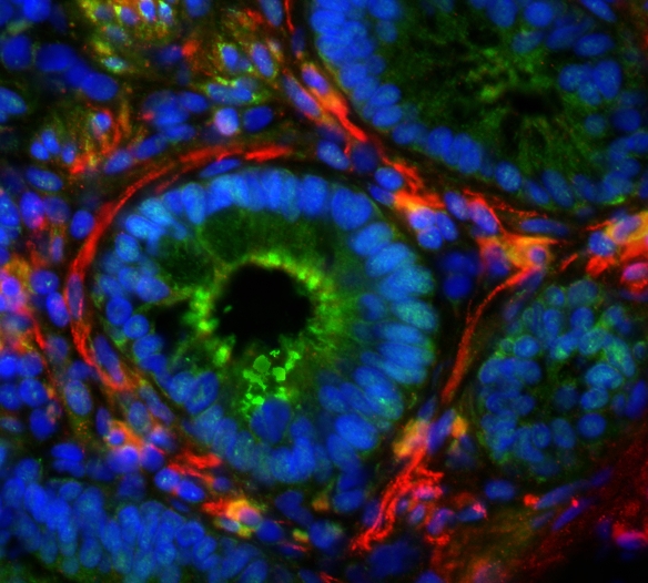 Intestinal mucosa cells under the microscope: Serotonin receptors are stained green, nerve fibers are stained red. 