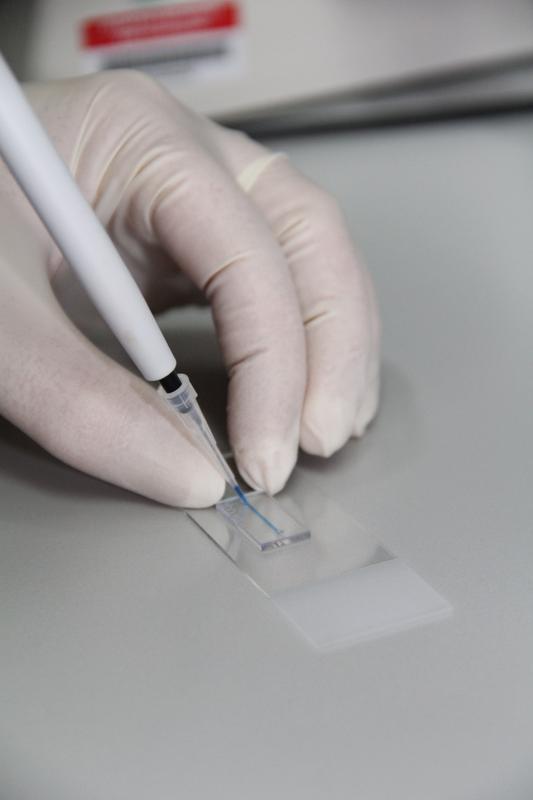 Ein 'Labor' kleiner als eine 1-Euromünze: Der Mikrochip, den die Hochschule Hamm-Lippstadt gemeinsam mit der iX-factory GmbH in einem neu gestarteten Forschungsprojekt entwickelt, um Leukämiediagnostik zukünftig in der Praxis zu ermöglichen.