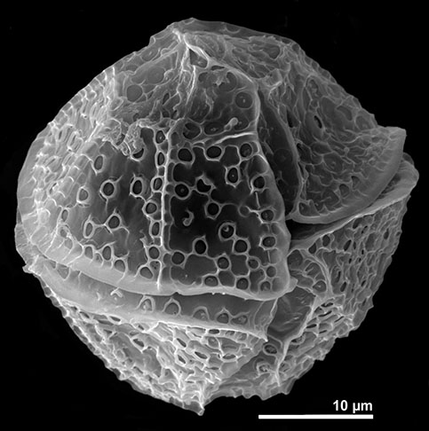 Lingulodinium polyedrum bildet Panzerplatten aus, die in der elektronenmikroskopischen Aufnahme sichtbar werden. Die Zellen haben eine  Länge von 35-55 µm. 