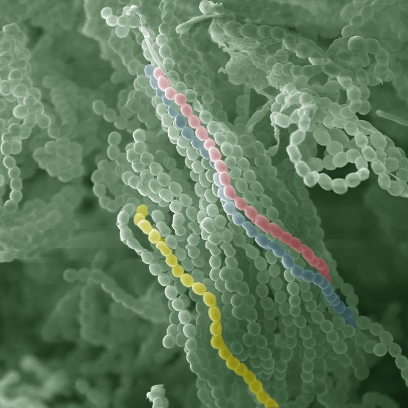 Scanning electron microscopic image of asexual conidiospores from the penicillin producer Penicillium chrysogenum