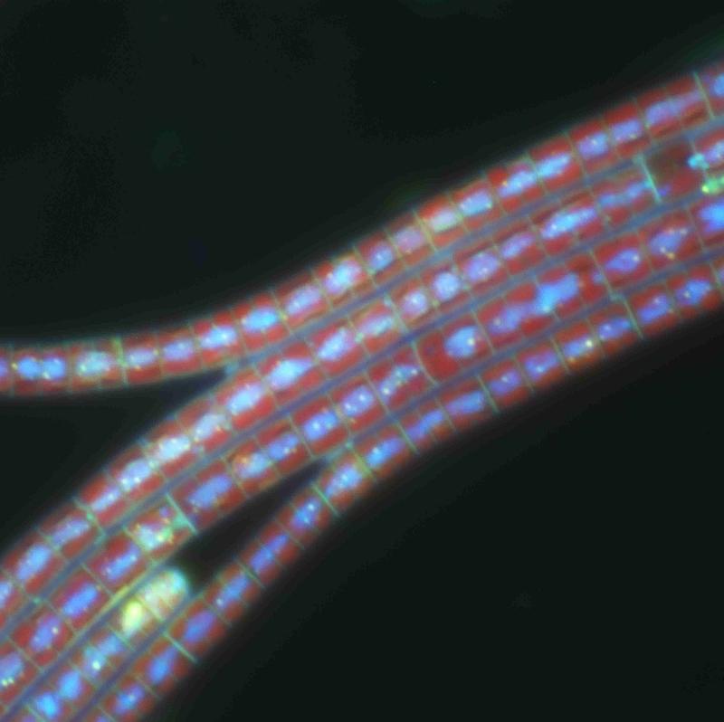 Toxische, rotpigmentierte Planktothrix rubescens: durch spezielle Färbung und Anregung im Mikroskop wurde die Erbsubstanz (DNA in blau) sichtbar gemacht.