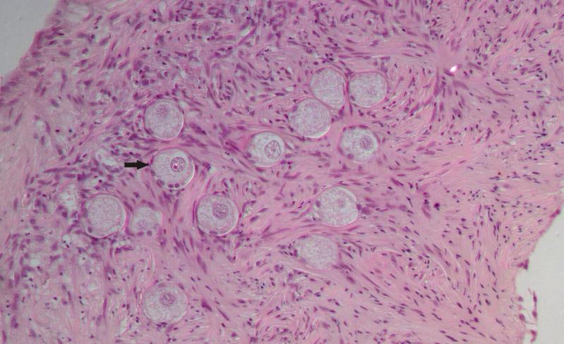 Histologischer Schnitt durch die Rinde eines Eierstocks von einer Löwin. Der Eierstock wurde nach dem Tod des Tieres gewonnen, die Rinde präpariert und eingefroren. Nach dem Auftauen sind deutlich die Eizellen im Gewebe (Pfeil) zu erkennen.
