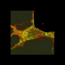 Darstellung von Mitochondrien (grün) in einer Nervenzelle (rot), deren Dysfunktion wesentlich an der Entstehung genetischer Formen des Morbus Parkinson beteiligt ist (Quelle: Helmholtz Zentrum München)