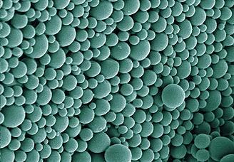 ©Fraunhofer IAP. Kleinste abbaubare Mikropartikeln aus Polymilchsäure setzen im Körper kontrolliert Medikamente frei. Breite des Bildfelds: 12 Mikrometer.