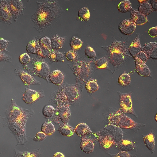 Fluoreszenzmarkierte Peptide für die optische Diagnostik reichern sich selektiv in Tumorzellen an.