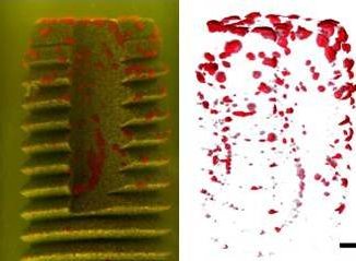 Darstellung der Oberflächenbesiedelung eines Dentalimplantates durch Bacillus cereus. Links: Kombination zweier Einzelprojektionen aus Streu- und Absorptionssignal durch Überlagerung der beiden Kanäle. Rechts: Rekonstruierter und gerenderter Volumendatensatz der einzelnen Bakterienkolonien (Skalierung: 500µm).