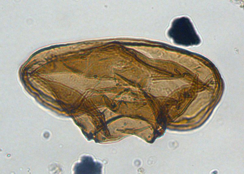Typische Dinoflagellatenzyste aus 33 Millionen Jahre altem Sediment. Größe: ca. 100 Mikrometer.