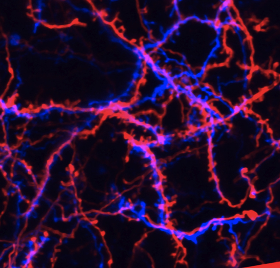 More networking than is needed: During long-term pain, calcium in the nucleus of neurons ensures that they establish more contacts to other pain-conducting neurons. This discovery by Heidelberg researchers explains how the pain memory is formed in the spinal cord. The image shows offshoots of neurons (red and blue) with the node-like contact sites (synapses). 