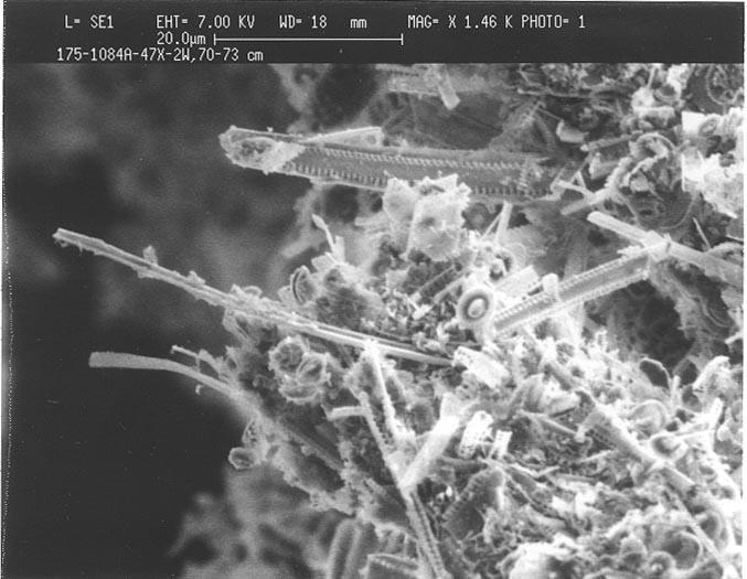 Elektronenmikroskopaufnahme: Kieselalgenreste im untersuchten Bohrkern (Foto: Scripps Institution of Oceanography)