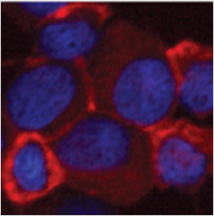 Fluoreszenz-mikroskopische Aufnahme von Lymphomzellen, die mit Nanobodies markiert sind. Die Kerne erscheinen durch die Färbung blau. Die Nanobodies sind mit einem Fluoreszenz-Farbstoff rot markiert und haften spezifisch an den Zielproteinen auf der Oberfläche der Zellen. Dadurch lassen sich die Zellen beziehungsweise Tumoren auch in lebenden Organismen nachweisen.