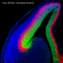 Developing forebrain