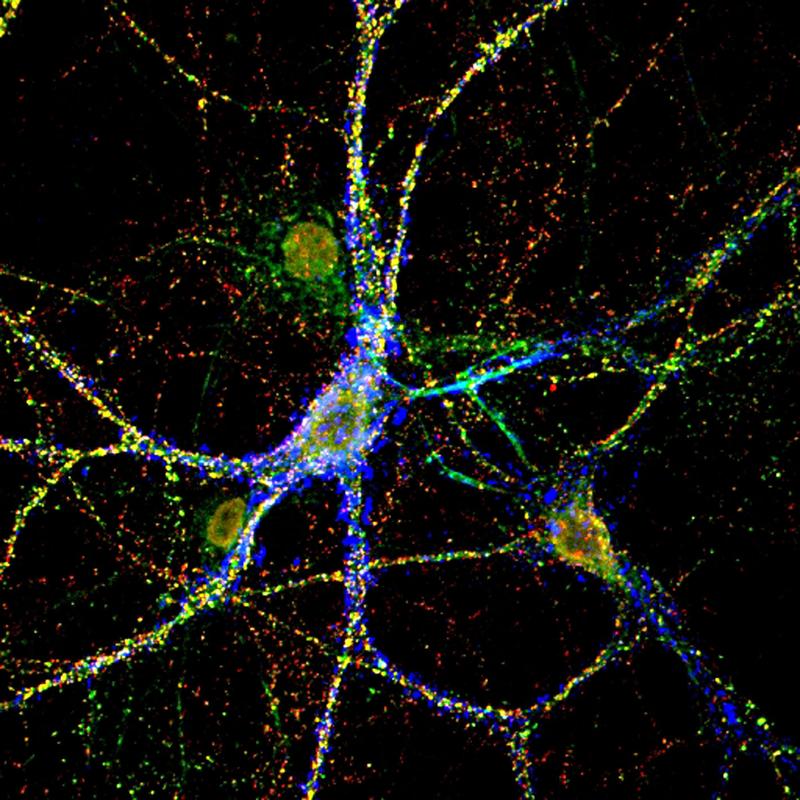 Nervenzelle im Netz: Das Bild zeigt eine Nervenzelle aus dem Hippocampus einer Maus in Zellkultur, die von einer speziellen Struktur der Extrazellulären Matrix umgeben ist – einem perineuronalen Netz (blau). Verschiedene Strukturen der Synapse sind rot, grün und gelb gefärbt.