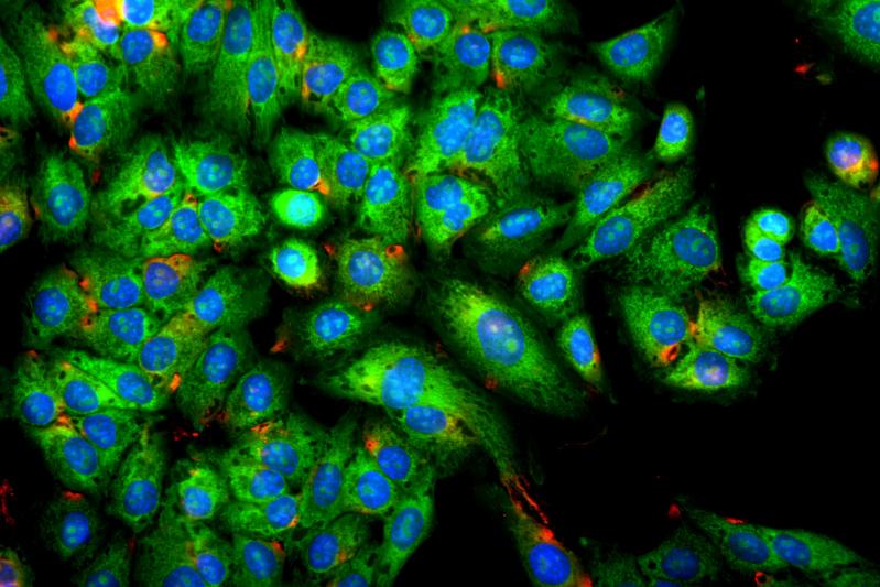 Neue Verfahren in der mikroskopischen Bildgebung tragen maßgeblich zu einem besseren Verständnis von Lebensprozessen auf zellulärer und molekularer Ebene bei. Hier: Dreifachfärbung einer Leberzelllinie (Zellkern blau, vitale Mitochondrien grün).