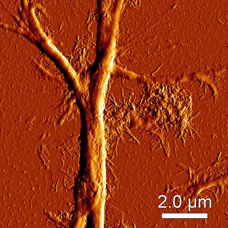 Iceman Brain Neurons