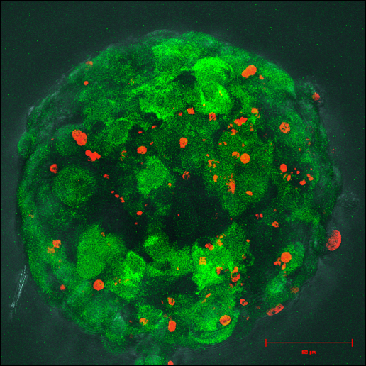 Menschliche Leberzellen im 3-D-Zellverband (Durchmesser 0,2 mm): Die grüne Farbe zeigt lebende Zellen an, die rote Färbung weist auf tote Zellen hin. 