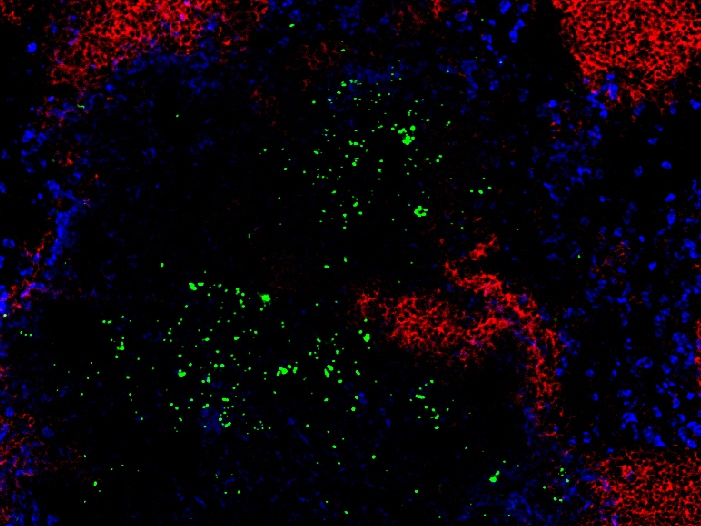 When infected with Listeria monocytogenes (green) it is important to have the right immune cells present at the right time. Too many natural killer cells for example can block the recruitment of neutrophilic granulocytes (red) which are vital for the immune response.