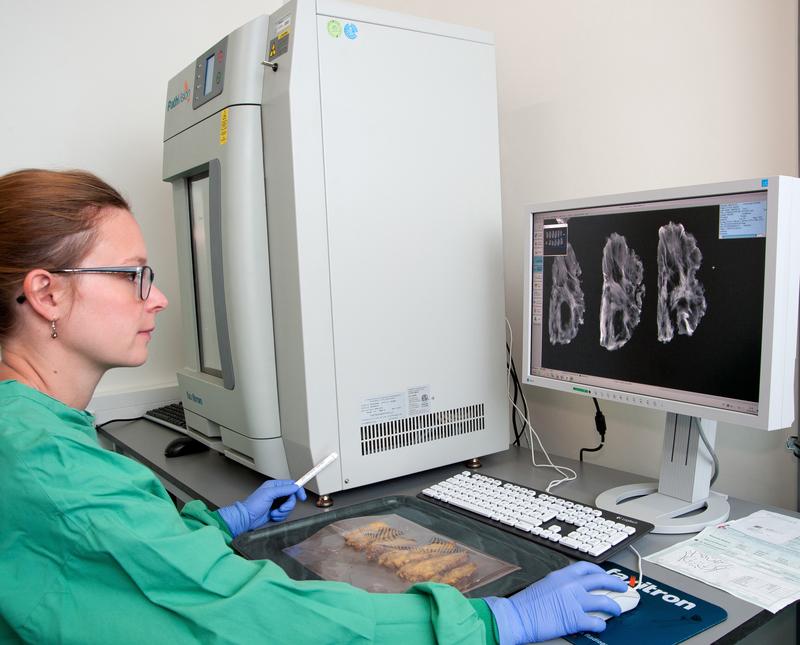 Schicht für Schicht durchleuchtet das neue Faxitron Gerät die Gewebeproben: Eine Mitarbeiterin beurteilt die digitalen Aufnahmen am Computer – ein wichtiger Schritt für die weitere Therapie bei Brustkrebs. 