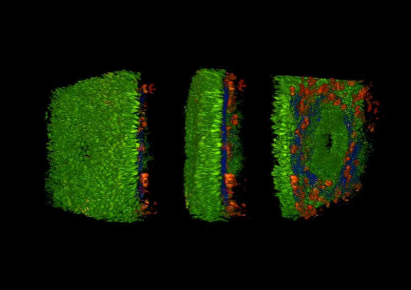 Eine Darmschleimhaut, wie sie sich durch das Multiphotonen-Mikroskop darstellt: Grün ist die reguläre Oberfäche der Darmschleimhaut, die Ephitelzellschicht, blau die Kollagenmatrix, rot sind Immunzellen, die in bestimmter Zahl auf Entzündungsreaktionen hinweisen können.