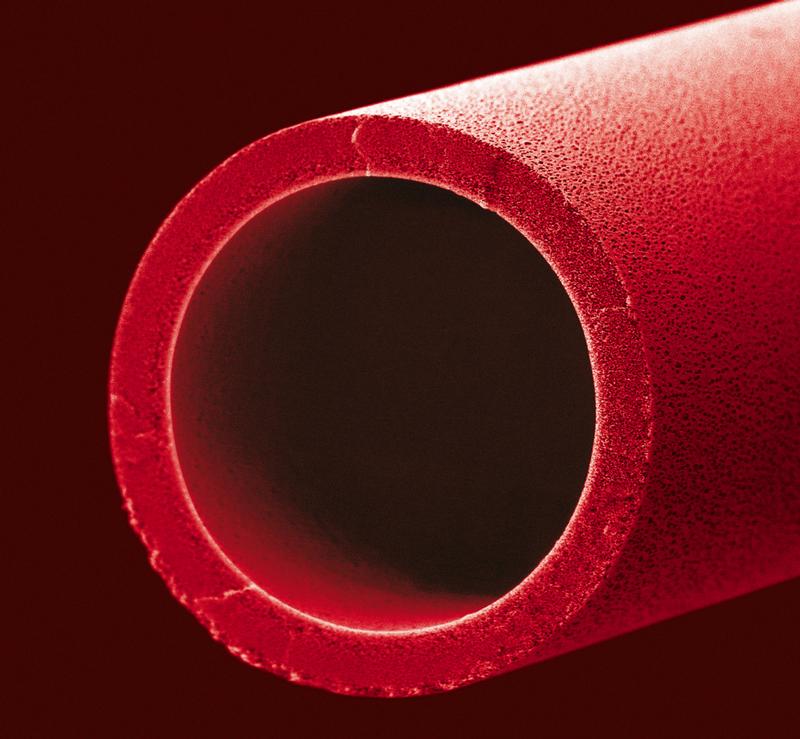Der Außendurchmesser der hohlen Kunststofffaser beträgt 0,4 Millimeter. Blutzellen strömen im Inneren, während Plasma durch die Poren austritt und dort von Toxinen befreit wird.