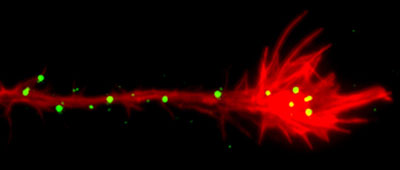 Abb. 1 Wachstumskegel eines Neurons aus dem Vorderhirn einer Maus mit Clustern von EphA4-Rezeptoren. Permanent aktivierte EphA4-Rezeptoren zeigen normales Cluster-Verhalten und vermitteln eine weitgehend normale Entwicklung des Nervensystems.