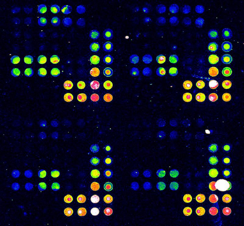 Speziell beschichteter Bio-Chip, der die gesuchten Autoantikörper im Blut der Schwangeren schnell und sicher erkennt