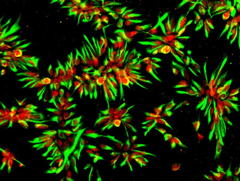 Aus iPS-Zellen eines Alzheimer-Patienten gewonnene neurale Stammzellen, mit denen sich im Labor kontinuierlich Nervenzellen für solche Tests herstellen lassen.