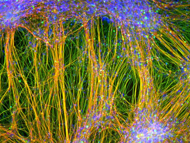 Aus neuralen Stammzellen gewonnene ausgereifte Nervenzellen: Das sind Zellen, an denen die Wirkstoffe getestet wurden. Typisch ist die Ausbildung langer Nervenfasern. 