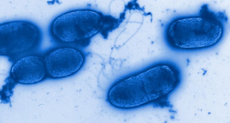Pseudomonas aeruginosa - ein weitverbreiteter Krankenhauskeim