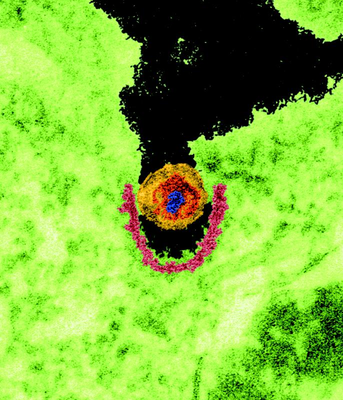 TEM-Photo: Porcine endogenous retrovirus (PERV). Green: infected cell cytoplasma; pink: so-called clathrin-coated pit; yellow: virus particle; red: virus core; blue: genetic material of the virus